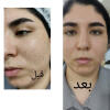 فیشال حیات