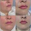 مطب زیبایی دکتر سودابه زارع