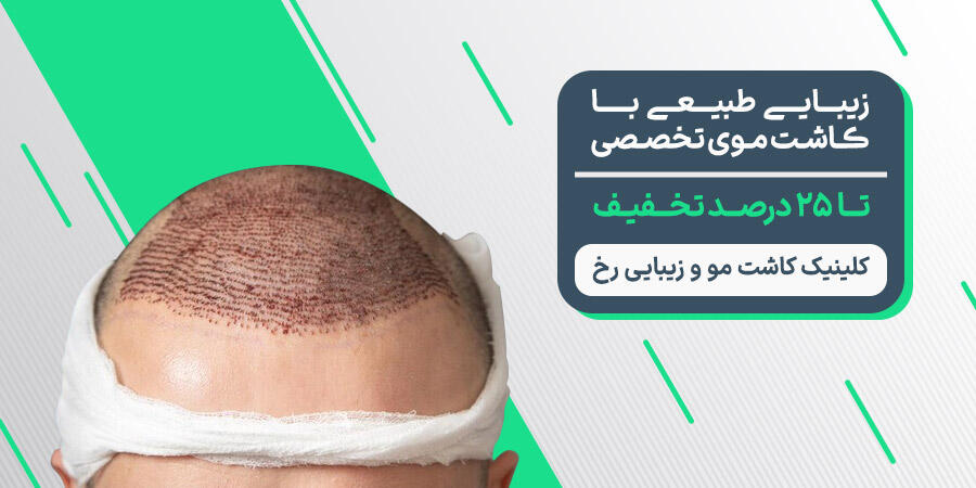 تخفیف ویژه برای کلینیک کاشت مو و زیبایی رخ در شیراز