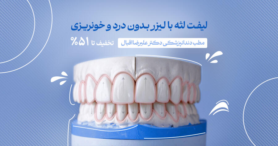 تخفیف ویژه برای مطب دندانپزشکی دکتر علیرضا اقبال در شیراز