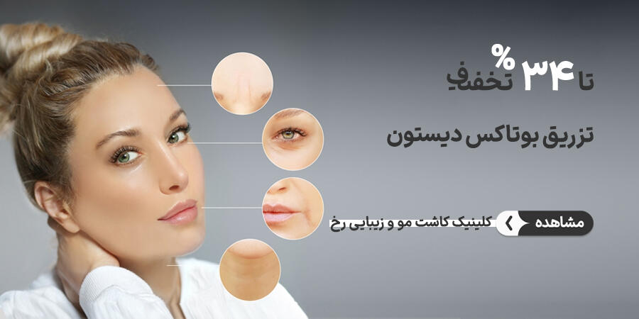 تخفیف ویژه برای رخ در شیراز