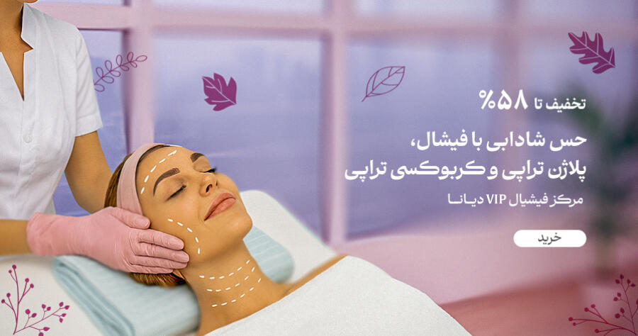 تخفیف ویژه برای دیانا در شیراز
