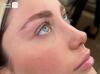 کاشت، لیفت و اکستنشن مژه و ابرو