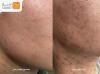 جوانسازی پوست و صورت و درمان آسیب با خاویار تراپی