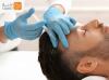 مزوتراپی (مو + جوانساز + چربی سوز) + میکرونیدلینگ