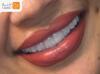 مطب دندانپزشکی دکتر بهناز خسروی