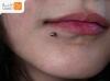 ارائه خدمات تخصصی پیرسینگ