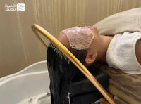 اسکراب اسکالپ (پاکسازی کف سر) + آموزش
