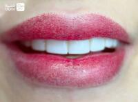 خدمات آرایش دائم به صورت تخصصی