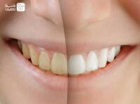 مطب دندانپزشکی دکتر فرزانه اشتیاق