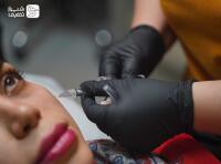 تزریق مزوژل جالپرو و پروفایلو