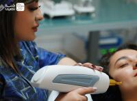 درمان لک های پوستی با لیزر کیوسوییچ ناب وی