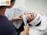 لیزر رفع تیرگی های بدن(کیوسوییچ) + پیلینگ کربن + ریموو تتو