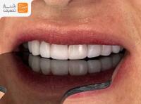 مطب دندانپزشکی دکتر بهناز خسروی