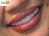 مطب دندانپزشکی دکتر بهناز خسروی