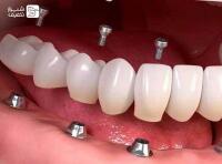 کلینیک تخصصی دندانپزشکی خاورمیانه