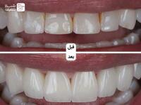 مطب دندان پزشکی دکتر مارال یوسفی