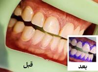 مطب دندان پزشکی دکتر مارال یوسفی