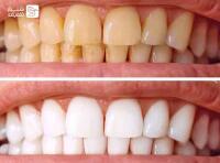 مطب دندانپزشکی دکتر صابری کیا و دکتر رجبیان