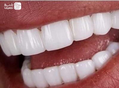 شیراز تخفیف