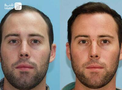 شیراز تخفیف