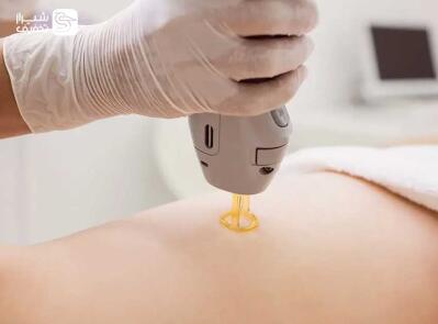 شیراز تخفیف