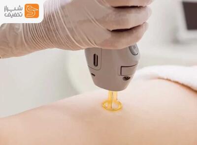 شیراز تخفیف