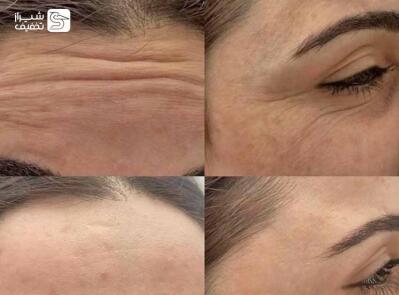 شیراز تخفیف