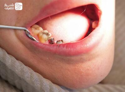 شیراز تخفیف