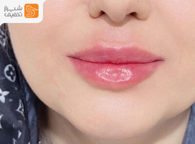 شیراز تخفیف