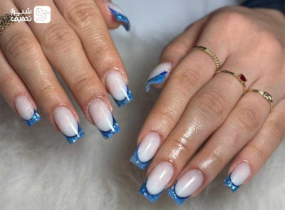 تخفیف ویژه برای کاشت و ترمیم ناخن با تخفیف ویژه در شیراز