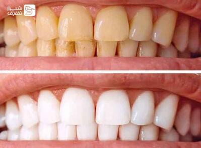 شیراز تخفیف