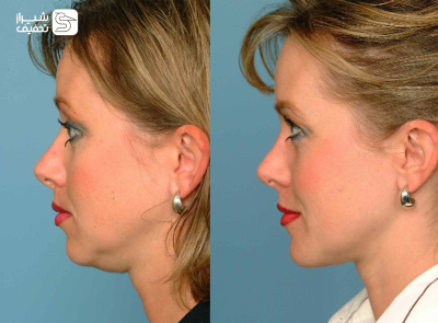 شیراز تخفیف