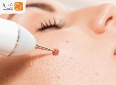 شیراز تخفیف