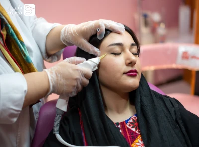 رفع چین و چروک صورت و درمان ریزش مو با کربوکسی تراپی