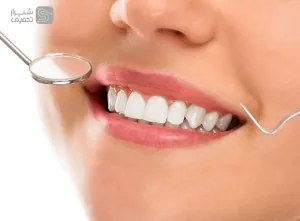 درخشندگی دندان‌ها با جرمگیری و بروساژ دندان